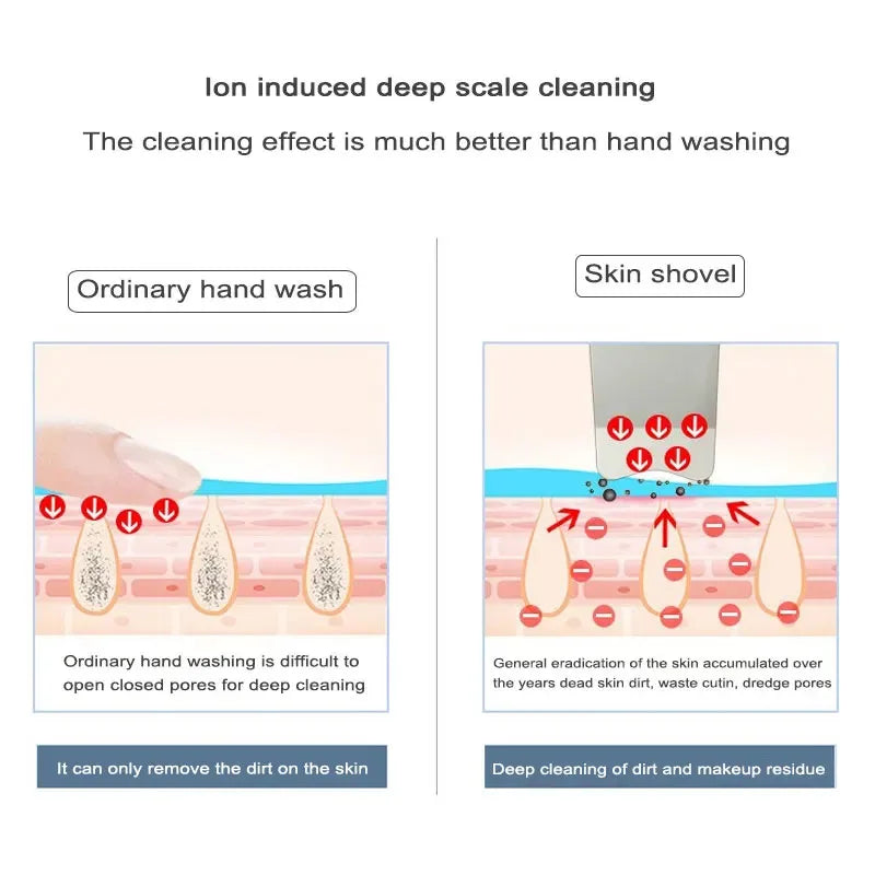 Ultrasonic Facial Skin Scrubber